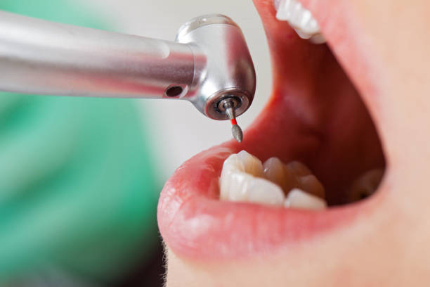 Best Emergency Cosmetic Dentistry in Wells Branch, TX